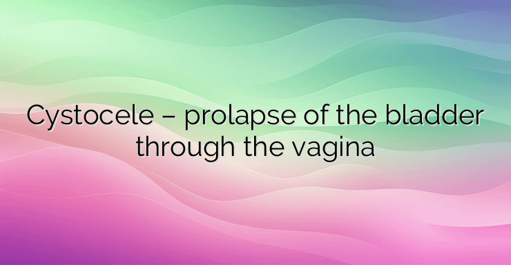 Cystocele – prolapse of the bladder through the vagina