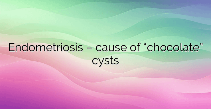 Endometriosis – cause of “chocolate” cysts