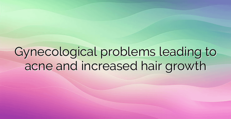 Gynecological problems leading to acne and increased hair growth