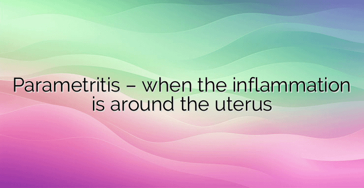 Parametritis – when the inflammation is around the uterus