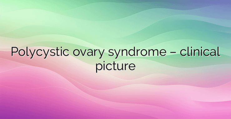 Polycystic ovary syndrome – clinical picture